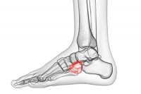 The Cuboid Bone Is One of Seven Tarsal Bones