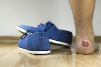 Blisters Protect Damaged Skin