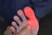 When the Big Toe Stops Bending