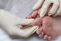 Diabetic Foot Infections