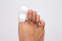 What to Expect When You Break Your Toe